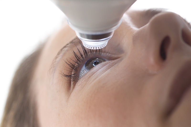 La cirugía refractiva es un procedimiento que corrige los defectos de graduación como miopía, hipermetropía y astigmatismo, se considera una cirugía de buen pronóstico pues en la mayoría de los casos permite conseguir una correcta visión sin la necesidad del uso de gafas o lentes de contacto de uso constante